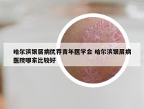 哈尔滨银屑病优荐青年医学会 哈尔滨银屑病医院哪家比较好