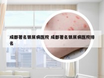 成都著名银屑病医院 成都著名银屑病医院排名