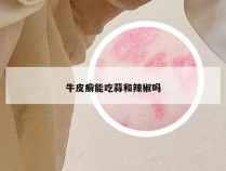 牛皮癣能吃蒜和辣椒吗