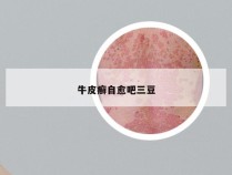 牛皮癣自愈吧三豆