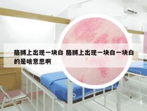 胳膊上出现一块白 胳膊上出现一块白一块白的是啥意思啊
