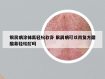 银屑病涂抹氟轻松软膏 银屑病可以用复方醋酸氟轻松酊吗