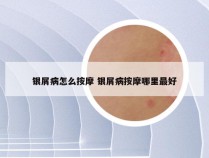 银屑病怎么按摩 银屑病按摩哪里最好