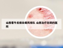 山西看牛皮癣白癜风排队 山西治疗白斑的医院