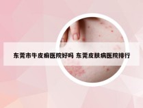 东莞市牛皮癣医院好吗 东莞皮肤病医院排行