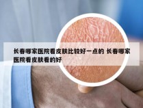 长春哪家医院看皮肤比较好一点的 长春哪家医院看皮肤看的好