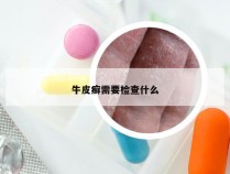 牛皮癣需要检查什么