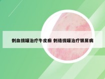 刺血拔罐治疗牛皮癣 刺络拔罐治疗银屑病
