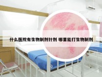 什么医院有生物制剂针剂 哪里能打生物制剂