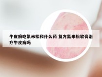 牛皮癣吃氟米松和什么药 复方氟米松软膏治疗牛皮癣吗