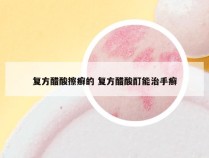 复方醋酸擦癣的 复方醋酸酊能治手癣