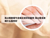 海口哪里看牛皮癣比较好的医院 海口看皮肤病什么医院好