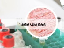 牛皮癣病人能吃鸭肉吗