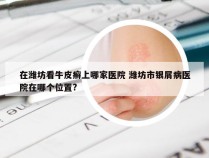 在潍坊看牛皮癣上哪家医院 潍坊市银屑病医院在哪个位置?