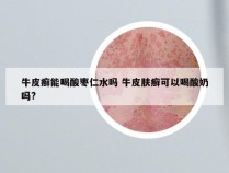 牛皮癣能喝酸枣仁水吗 牛皮肤癣可以喝酸奶吗?