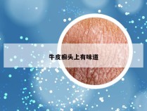 牛皮癣头上有味道