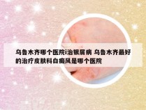乌鲁木齐哪个医院i治银屑病 乌鲁木齐最好的治疗皮肤科白癜风是哪个医院