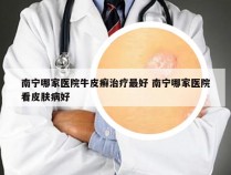 南宁哪家医院牛皮癣治疗最好 南宁哪家医院看皮肤病好