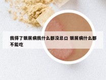 我得了银屑病我什么都没忌口 银屑病什么都不能吃