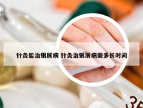 针灸能治银屑病 针灸治银屑病需多长时间