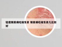 轻度银屑病吃维生素 银屑病吃维生素几比较好