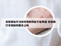 皮肤病治疗注射生物制剂能不能喝酒 皮肤病打生物制剂要忌口吗