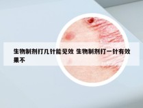 生物制剂打几针能见效 生物制剂打一针有效果不