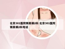 北京301医院银屑病2科 北京301医院银屑病2科电话