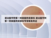 遵义医学院第一附属医院皮肤科 遵义医学院第一附属医院皮肤科专家嘴角旁边