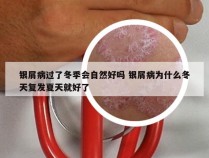 银屑病过了冬季会自然好吗 银屑病为什么冬天复发夏天就好了