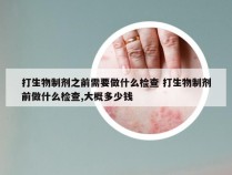 打生物制剂之前需要做什么检查 打生物制剂前做什么检查,大概多少钱