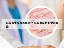 乌头长牛皮癣怎么治疗 乌头有白色的要怎么治