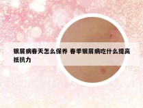 银屑病春天怎么保养 春季银屑病吃什么提高抵抗力