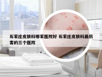 石家庄皮肤科哪家医院好 石家庄皮肤科最厉害的三个医院