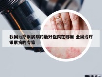 我国治疗银屑病的最好医院在哪里 全国治疗银屑病的专家