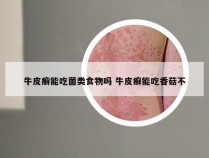 牛皮癣能吃菌类食物吗 牛皮癣能吃香菇不