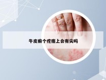 牛皮癣个疙瘩上会有尖吗
