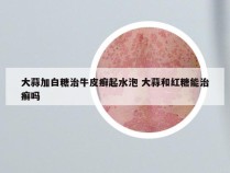大蒜加白糖治牛皮癣起水泡 大蒜和红糖能治癣吗