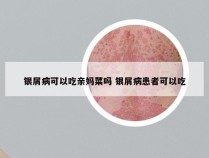 银屑病可以吃亲妈菜吗 银屑病患者可以吃