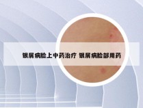 银屑病脸上中药治疗 银屑病脸部用药