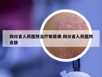 四川省人民医院治疗银屑病 四川省人民医院皮肤