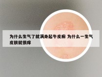 为什么生气了就满身起牛皮癣 为什么一生气皮肤就很痒