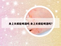 身上长癣能喝酒吗 身上长癣能喝酒吗?