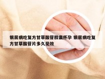 银屑病吃复方甘草酸苷胶囊怀孕 银屑病吃复方甘草酸苷片多久见效