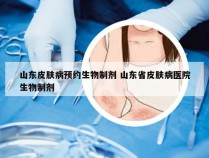 山东皮肤病预约生物制剂 山东省皮肤病医院生物制剂