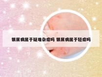 银屑病属于疑难杂症吗 银屑病属于轻症吗