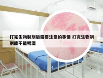 打完生物制剂后需要注意的事情 打完生物制剂能不能喝酒