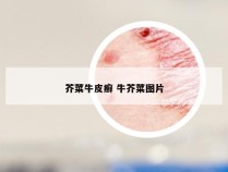 芥菜牛皮癣 牛芥菜图片