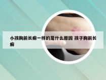 小孩胸前长癣一样的是什么原因 孩子胸前长癣