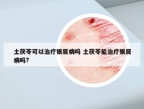 土茯苓可以治疗银屑病吗 土茯苓能治疗银屑病吗?